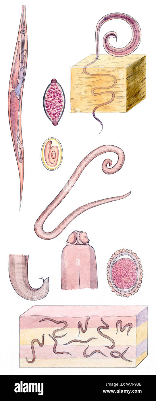 Illustration of Pinworms / Threadworms (Enterobius vermicularis) and