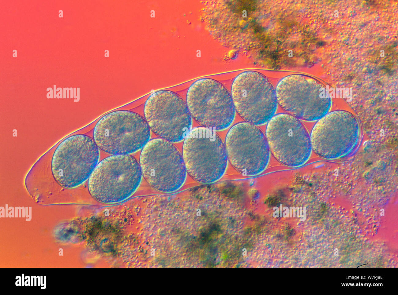 Tardigrade (Hypsibius dujardini) cuticle containing eggs. Stock Photo