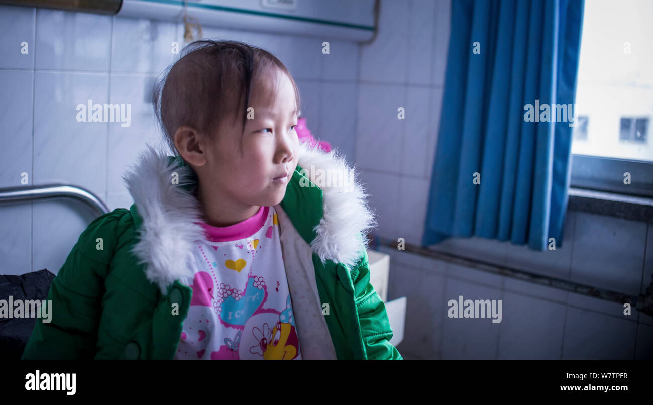 Eight Year Old Chinese Girl Guo Jinyan Diagnosed With Leukemia Receives Treatment In A Hospital In Nanyang City Central China S Henan Province 23 Ma Stock Photo Alamy