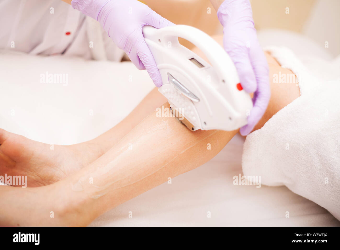 Body Care Laser Hair Removal Epilation Treatment Smooth Skin