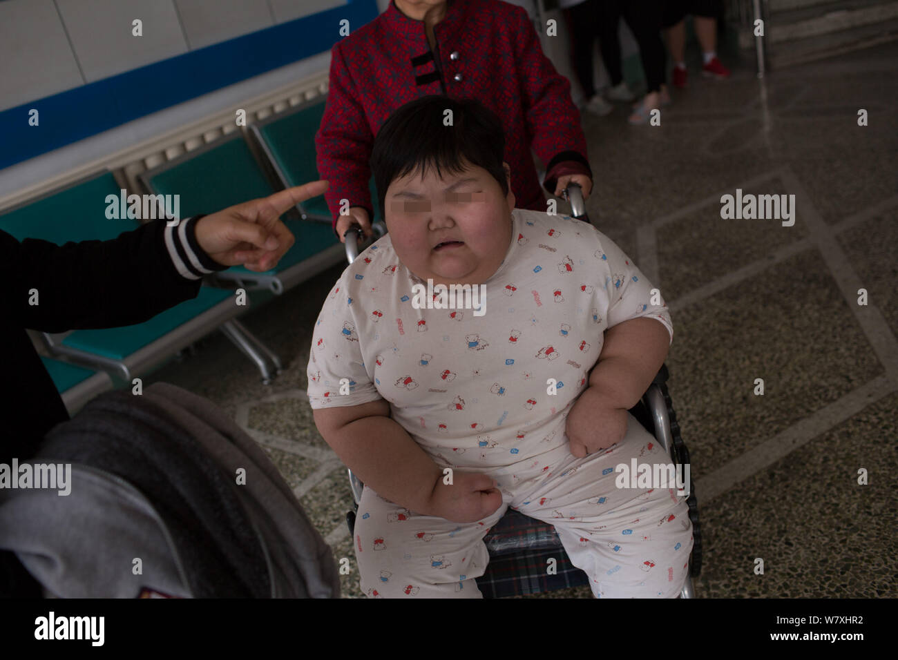Chinese 75kilogram girl Xiao Yun is pictured in a wheelchair in the