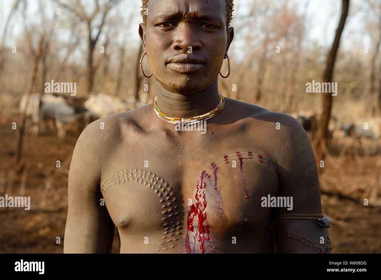 Young man from the Bodi Tribe with new scars on his chest. Omo Valley,  Ethiopia, March 2015.. Stock Photo