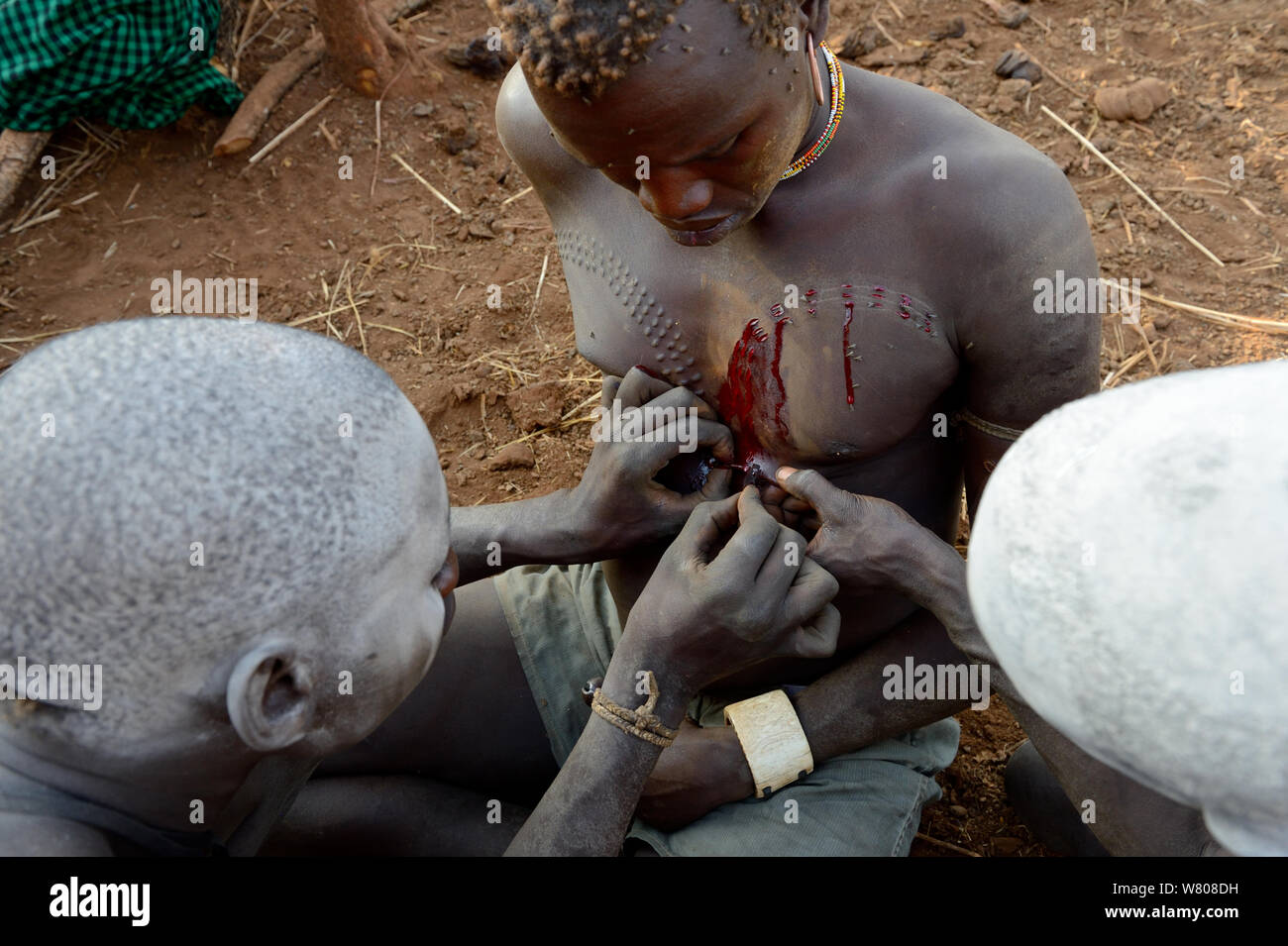 Young man from the Bodi Tribe with having new scars made on his chest with razor blade  to make decorative skin scarifications. Omo Valley,  Ethiopia, March 2015. Stock Photo