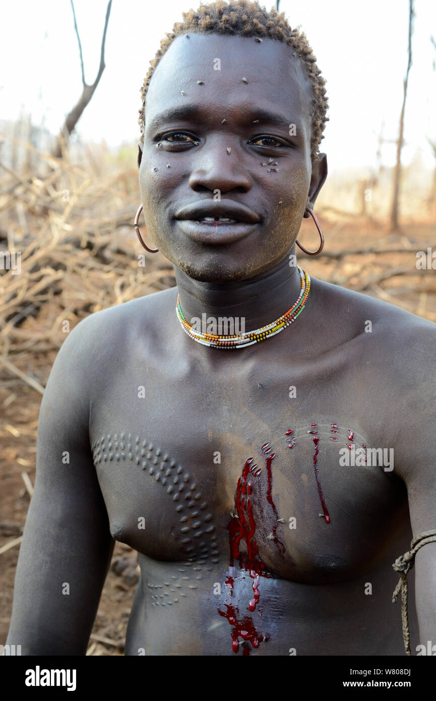 Young man from the Bodi Tribe with new scars on his chest to make decorative skin scarifications. Omo Valley,  Ethiopia, March 2015.. Stock Photo