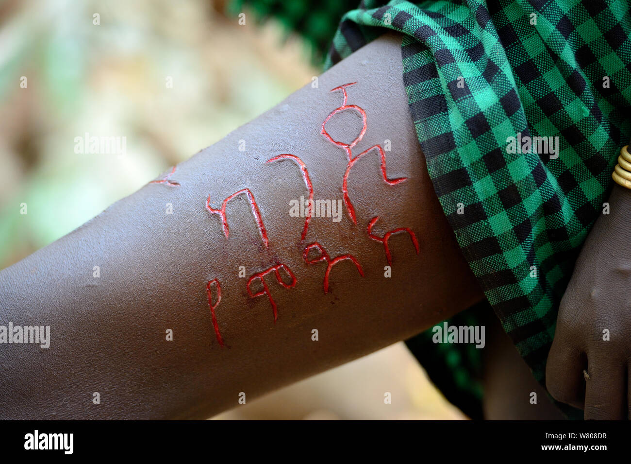 Young woman from the Bodi tribe displaying elaborate skin scarifications on her leg, her name in Amharic language, Omo Valley, Ethiopia, March 2015. Stock Photo