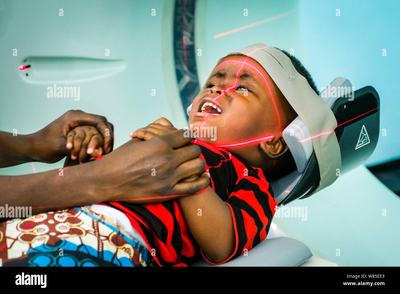 Girl (3 years old) who is suffering from hydrocephalus (spina bifida) in a CT-scanner (computer tomography) at the catholic St. Clare Clinic of the German missionary doctor Dr. med. Thomas Brei in Mwanza, Tanzania, Africa Stock Photo