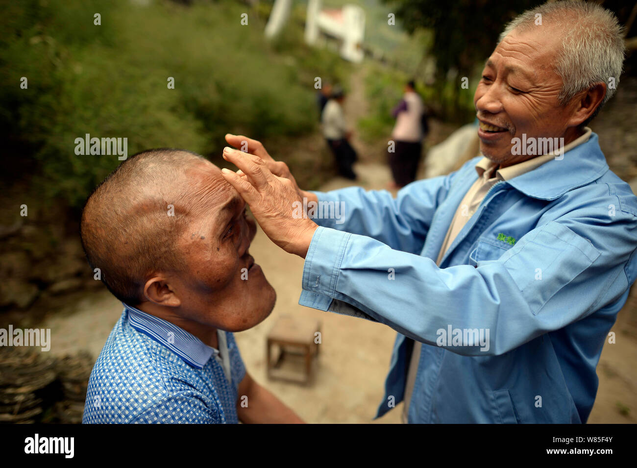 Chinese villager Xia Yuanhai, left, who has an alien-like deformed face talks with his elder brother Xia Yuanchang near home in Laotu village, Changli Stock Photo