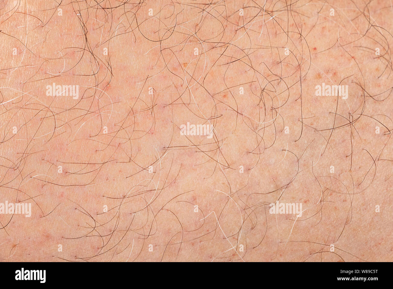 Abstract background of male adult human skin with hair Stock Photo