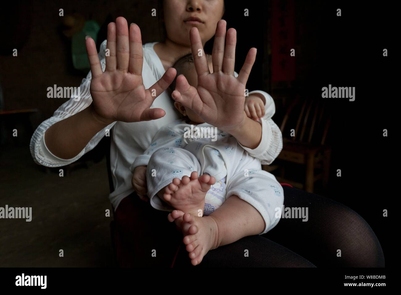 The mother of the three-month-old baby boy Hong Hong who has 15 fingers and 16 toes shows her both hands with 12 fingers at home in Zhongping village, Stock Photo