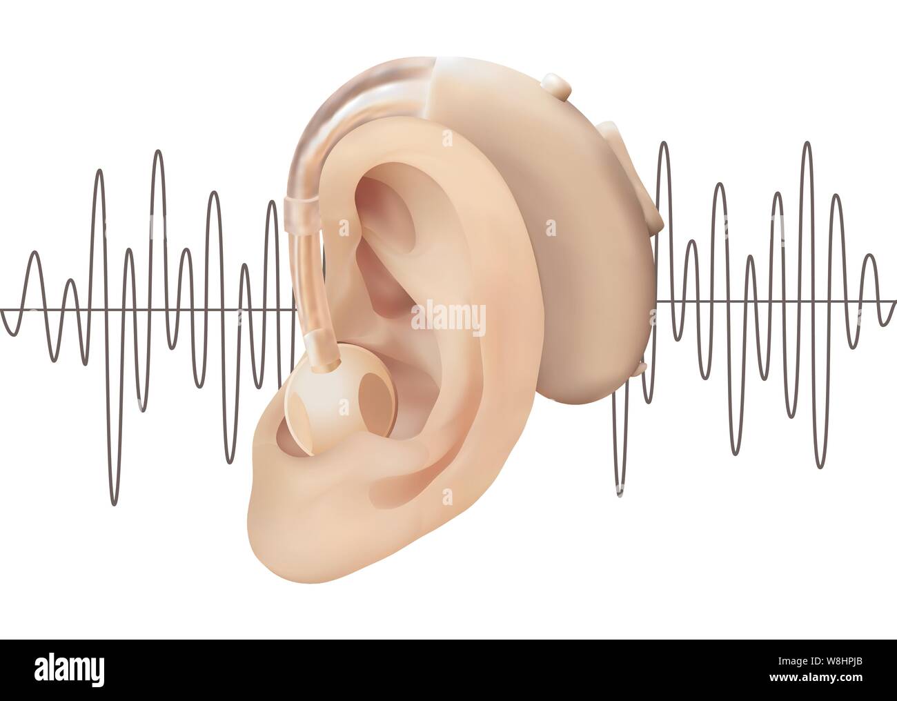 Digital hearing aid behind the ear, on the background of sound wave diagram. Treatment and prosthetics of hearing loss in otolaryngology. Realistic Stock Vector