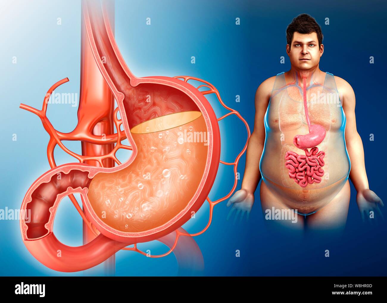 Illustration of a man with stomach acidity Stock Photo - Alamy