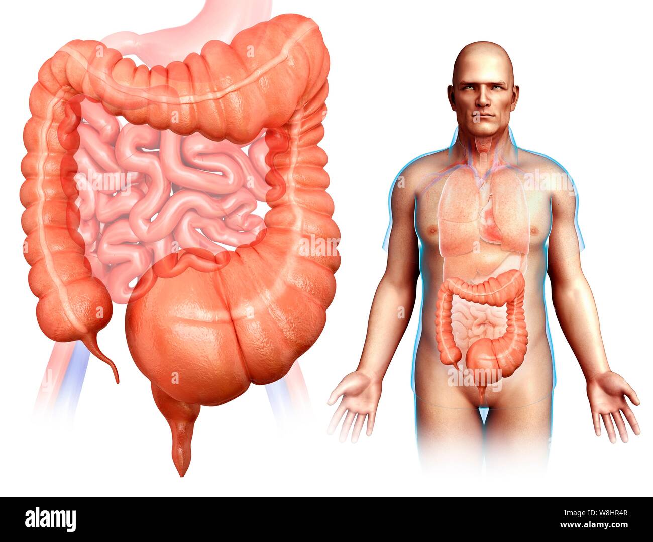 Illustration of a man with mega colon Stock Photo - Alamy