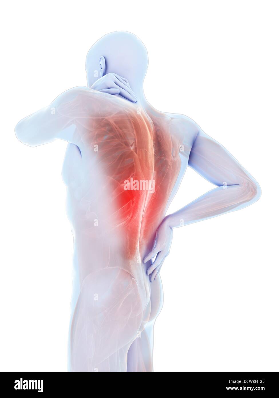 Back pain, computer illustration Stock Photo - Alamy