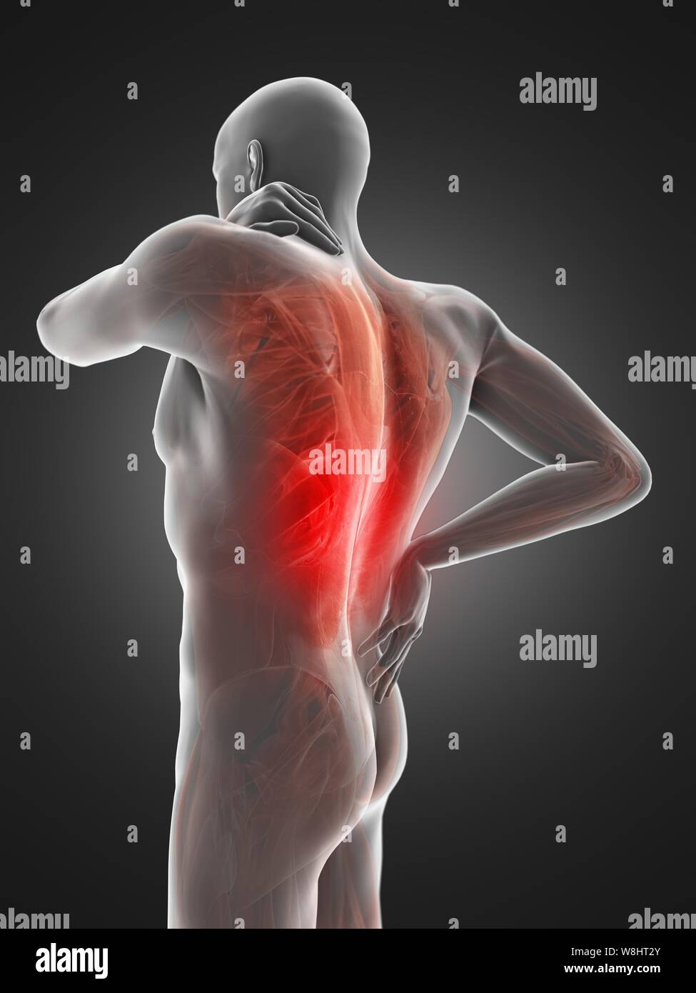 Back pain, computer illustration Stock Photo - Alamy
