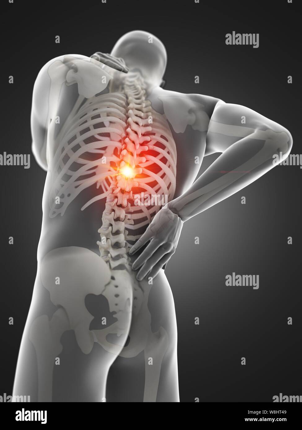 Back pain, computer illustration. Stock Photo