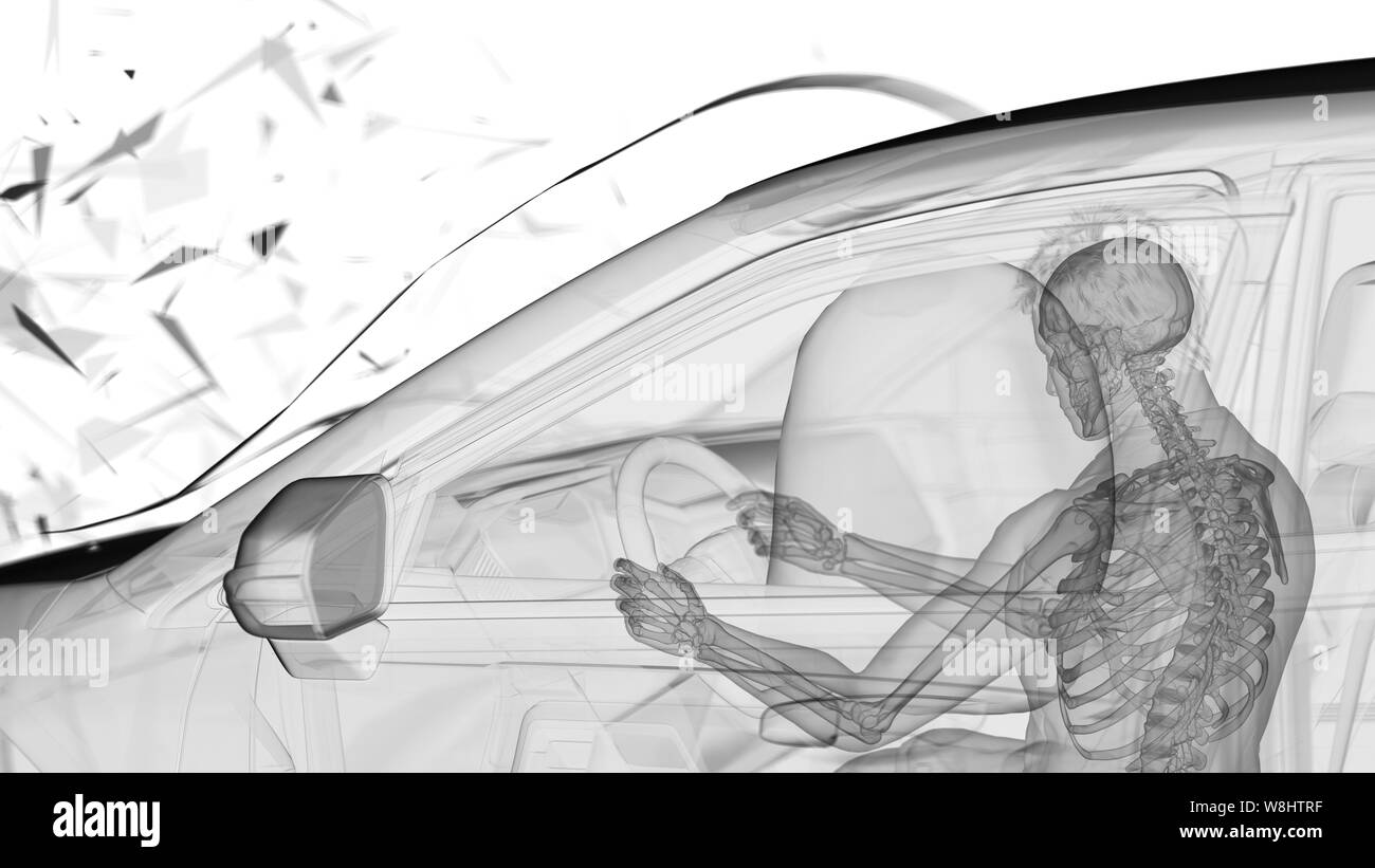 Airbag deployed in car crash, computer illustration. Stock Photo