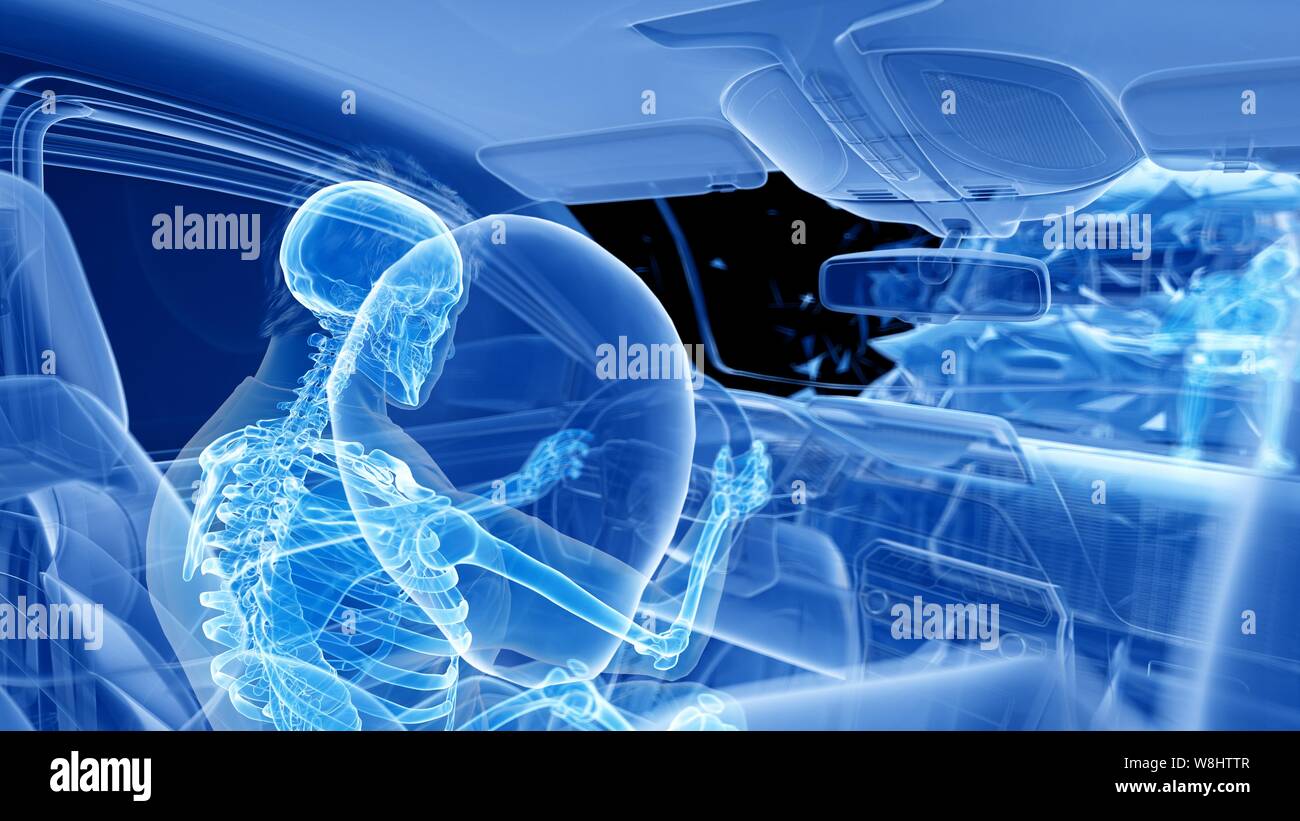 Airbag deployed in car crash, computer illustration. Stock Photo