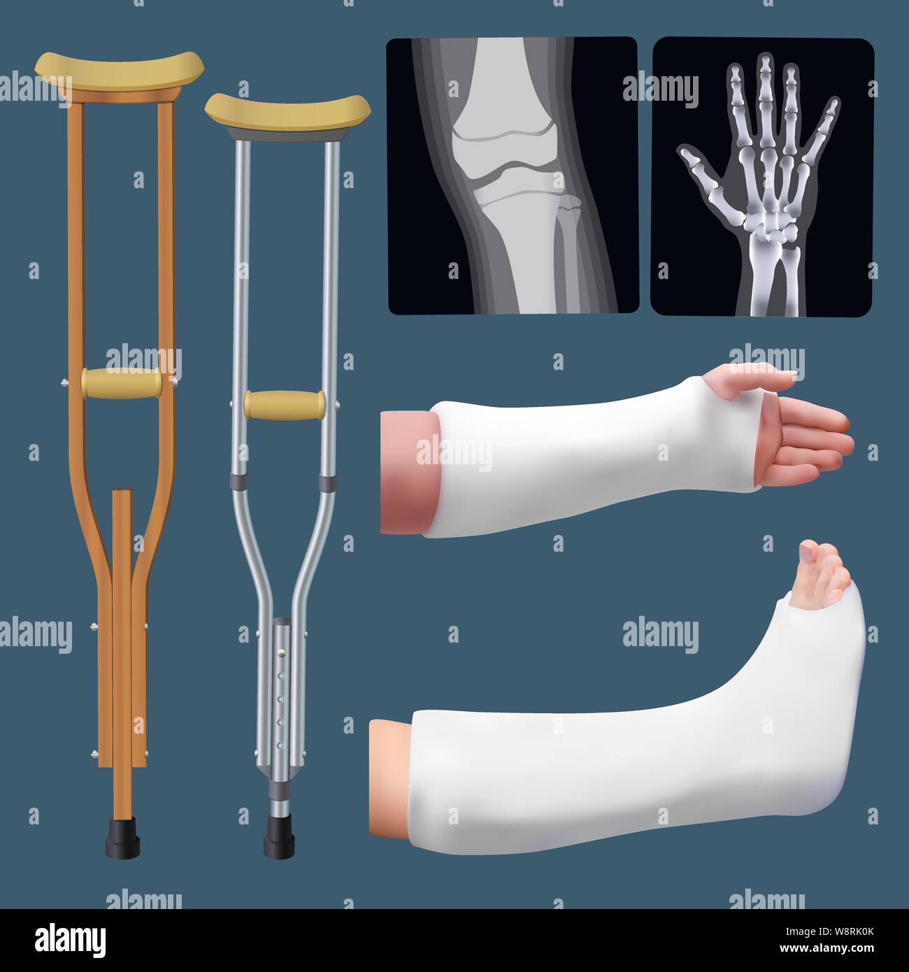 Set of medicine traumatology objects. Treatment of bone fracture. Plaster  splint, crutch, x-ray. Isolated objects. Vector Stock Vector Image & Art -  Alamy