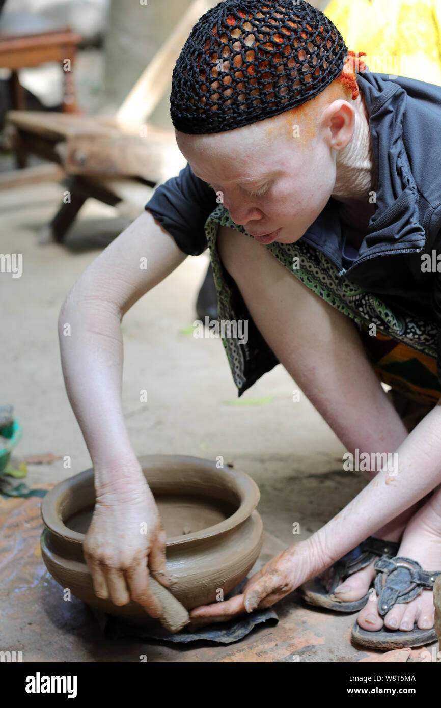 Albino woman in Ukerewe, Tanzania. Many traditional healers have been arrested recently in Tanzania because of albino murders Stock Photo