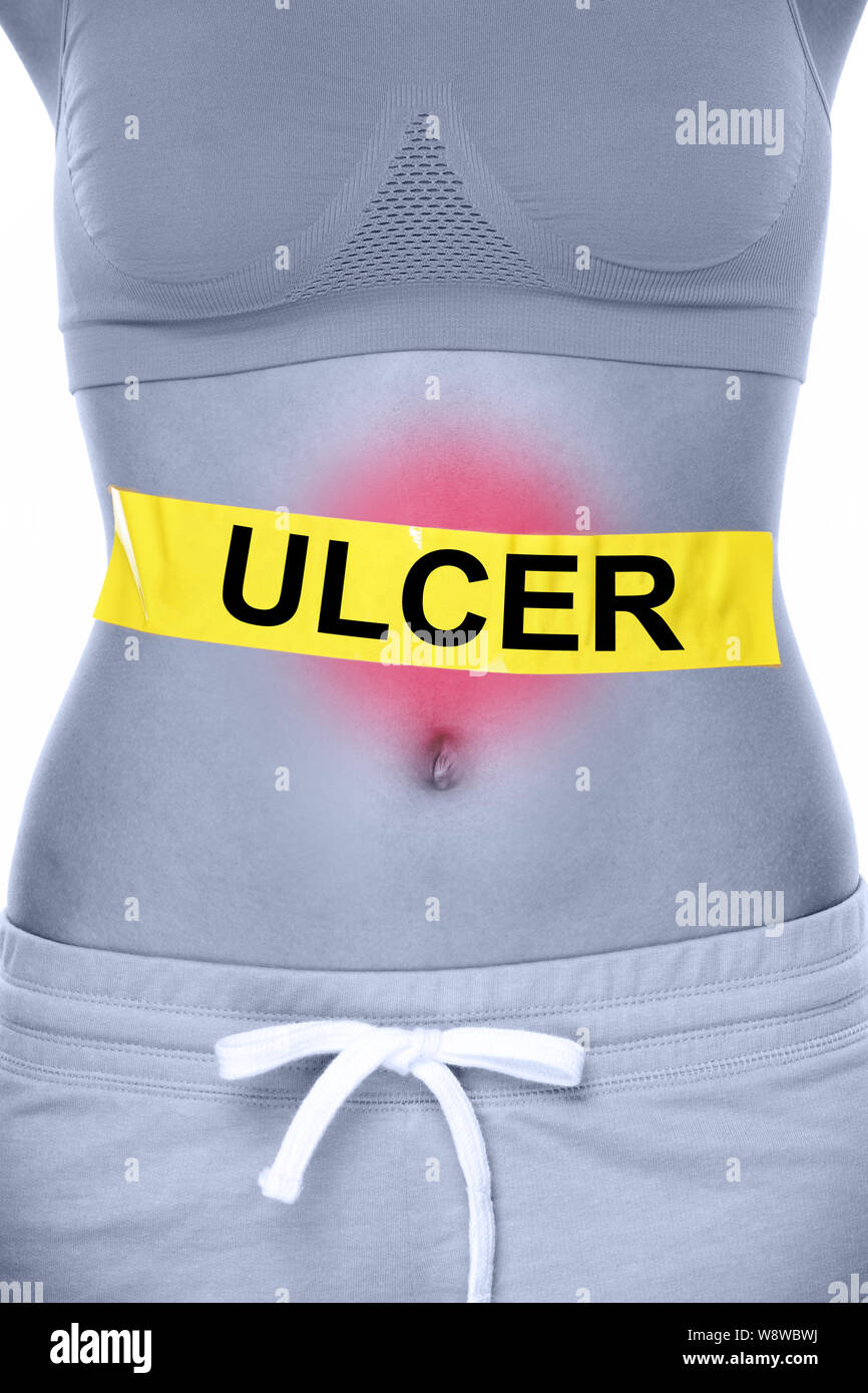 Stomach ulcer health problem showing woman abdomen belly ULCER sign. Gastric ulcer / Peptic Ulcer concept. Conceptual health image. Stock Photo