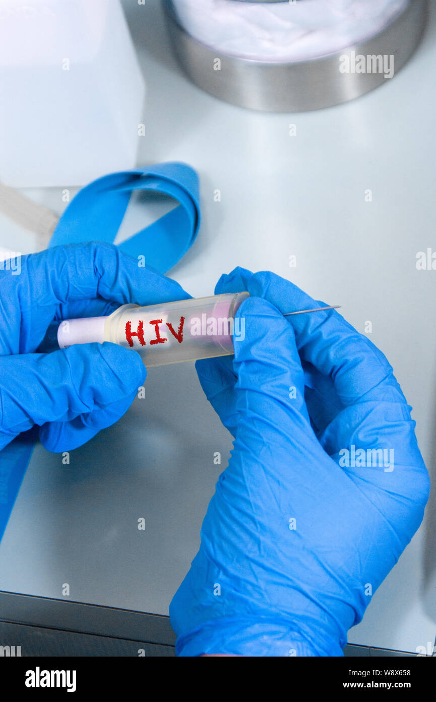 Hiv aids microscope hires stock photography and images Alamy