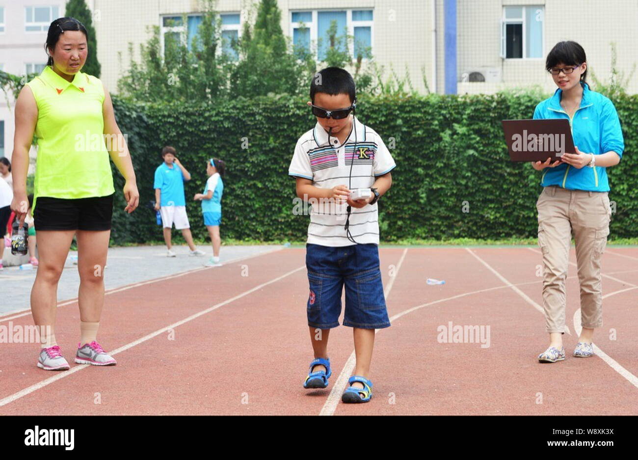 7yearold Chinese boy Guo Bin, center, nicknamed Bin Bin, whose eyes