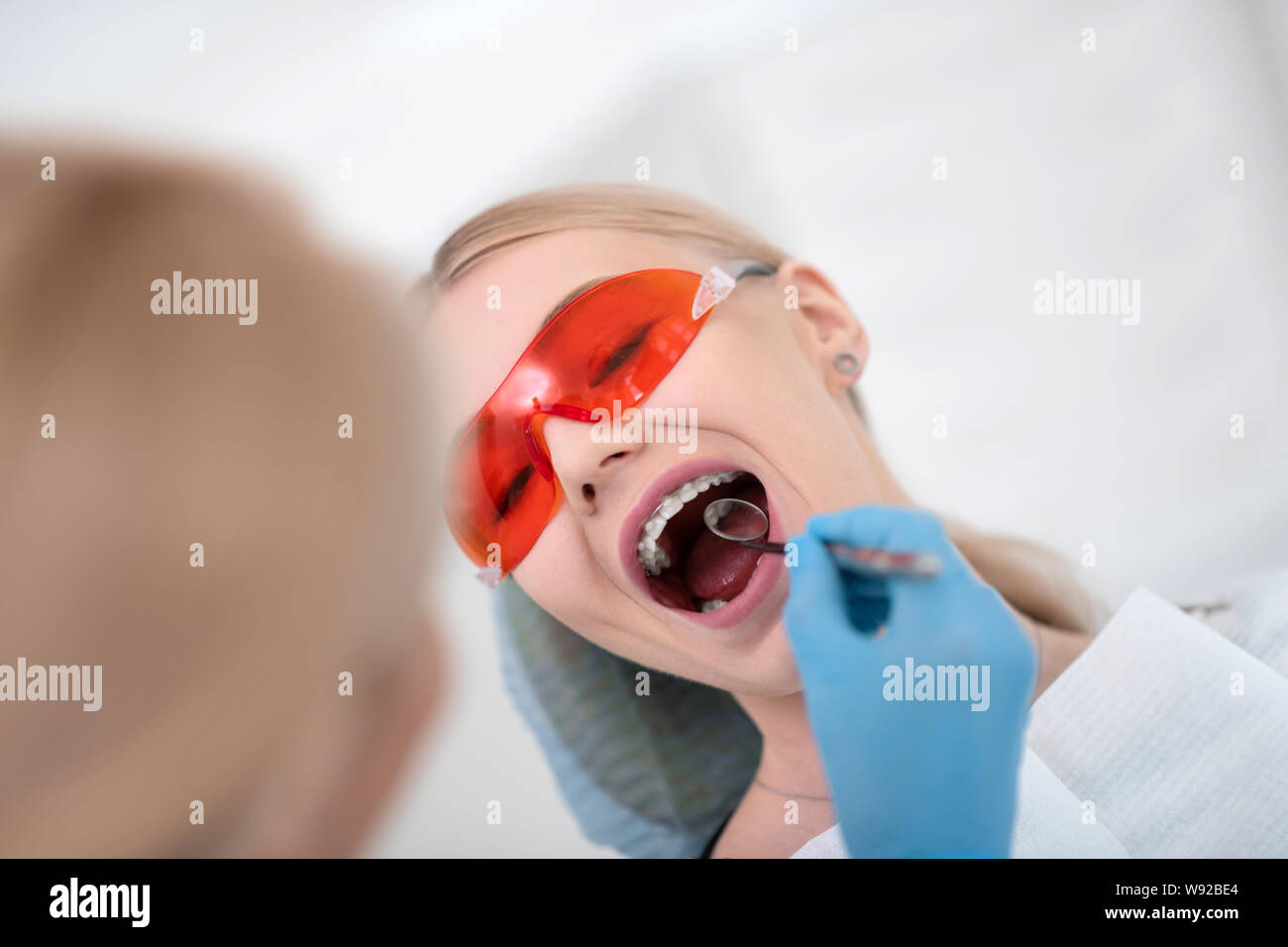 Dentists patient wearing protective glasses opening her mouth Stock