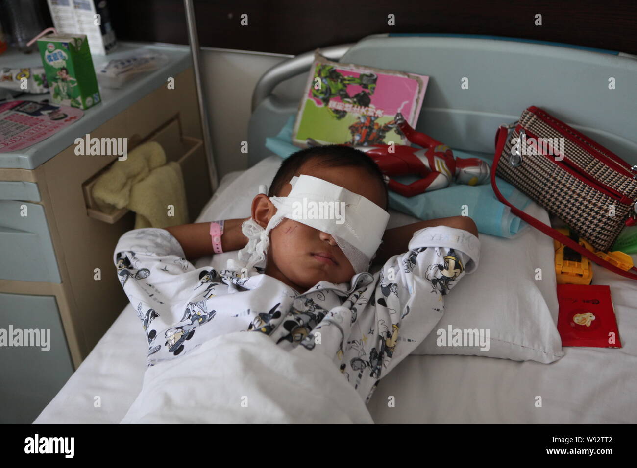 The 6yearold Chinese boy Bin Bin, whose eyes were gouged out in a