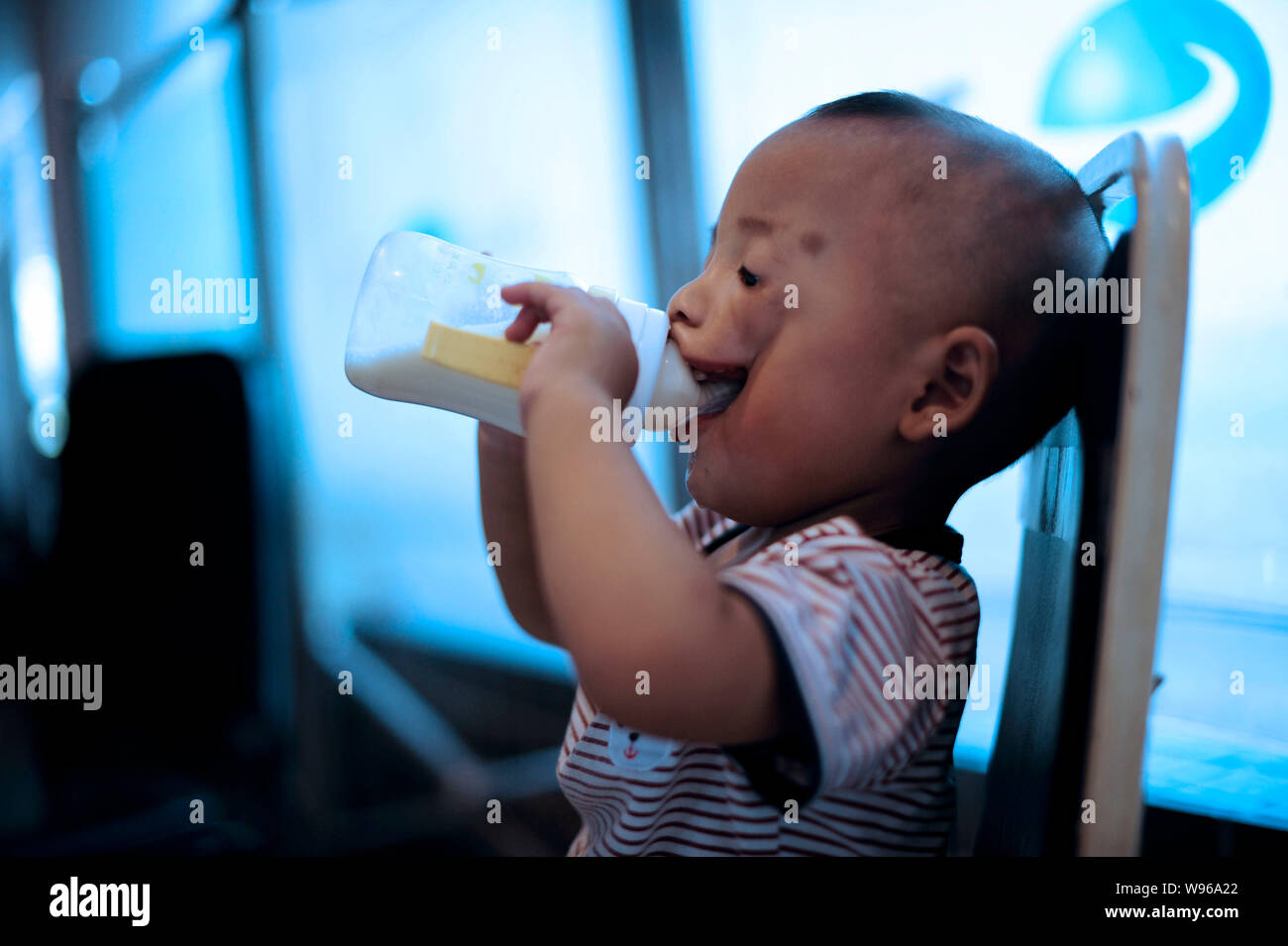 Junjun, who was born with a congenital facial cleft palate, is seen drinking milk at a hospital in Chongqing, China, 30 July 2012.   Junjun is a 1-yea Stock Photo