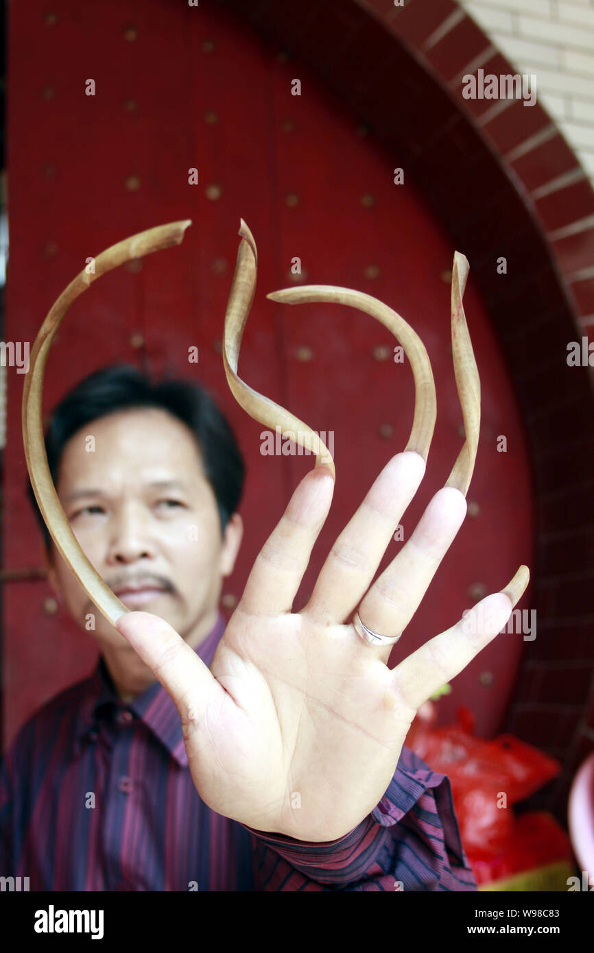 Asian Long Nails Hand Job Complications