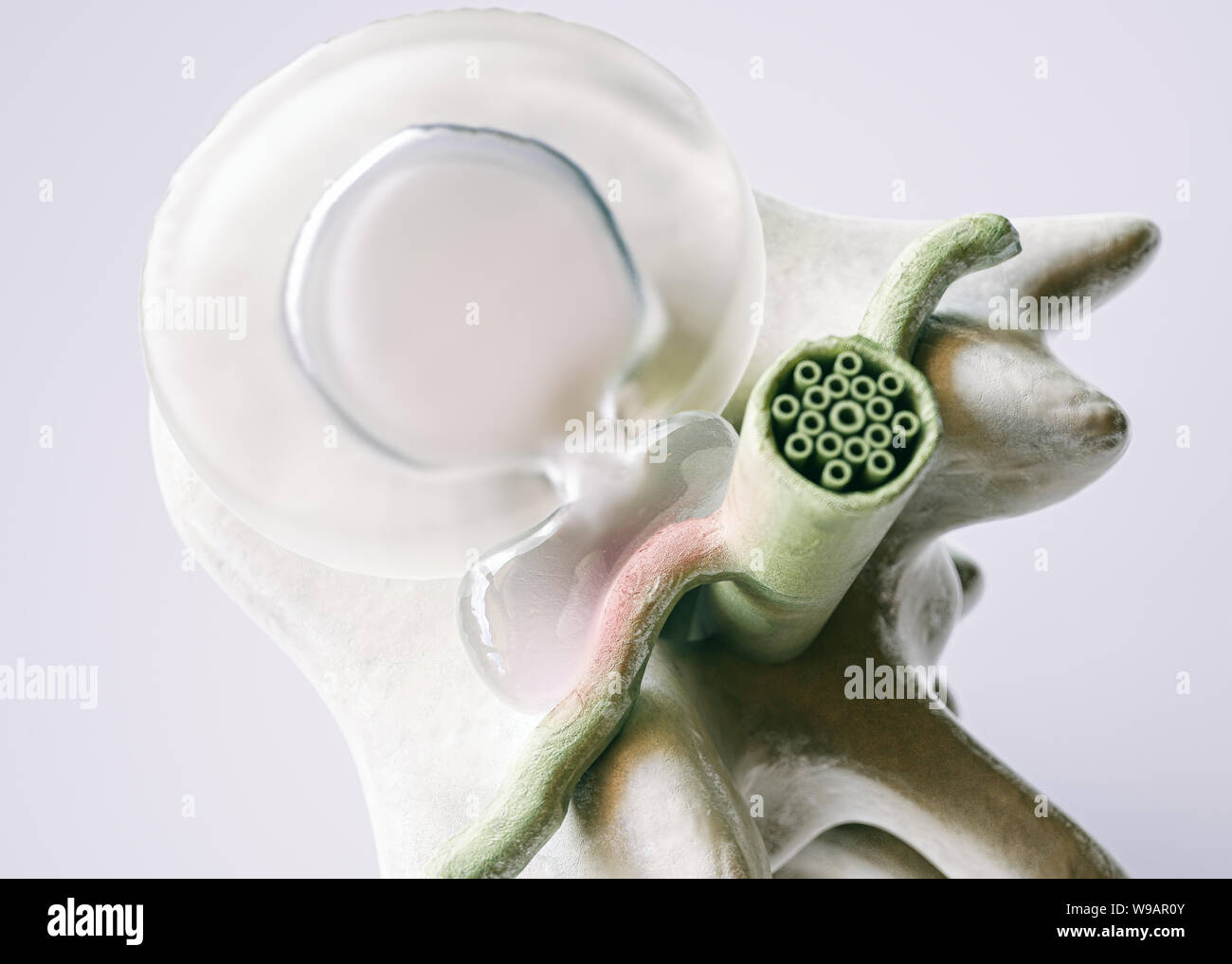 Spinal disc herniation as close-up detailed 3D Rendering Stock Photo