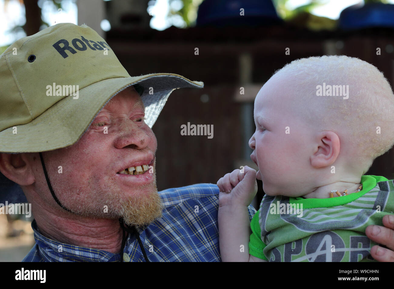 Albino father and son in Ukerewe, Tanzania. Many traditional healers have been arrested recently in Tanzania because of albino murders Stock Photo