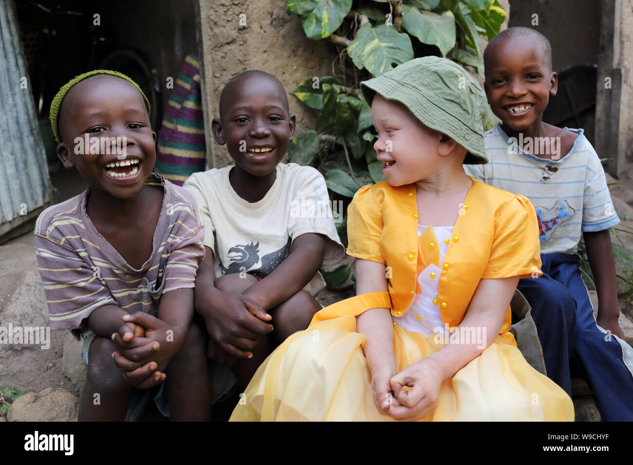 Albino child and boys in Ukerewe, Tanzania. Many traditional healers have been arrested recently in Tanzania because of albino murders Stock Photo