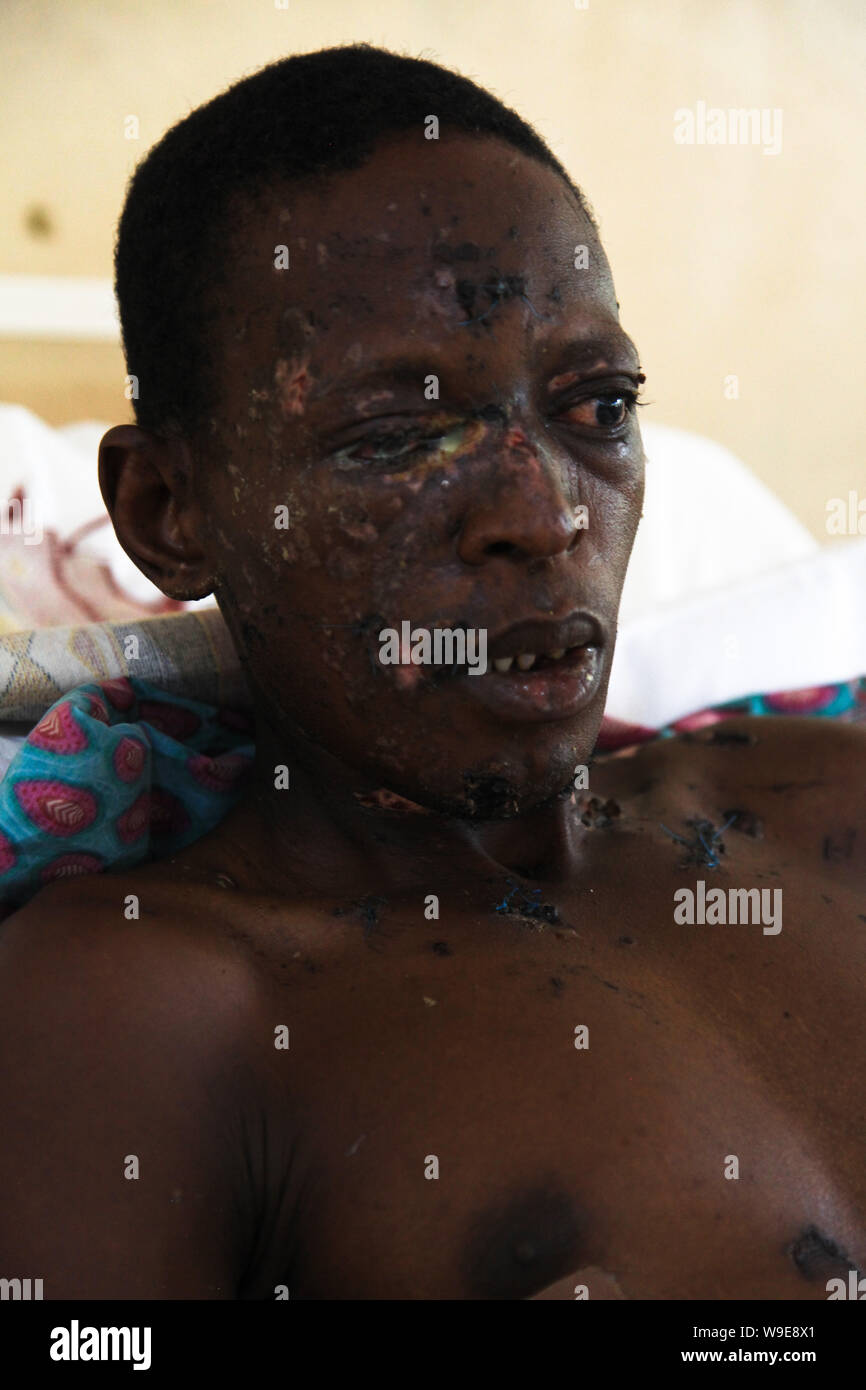 Nigeria bomb blast victims Stock Photo