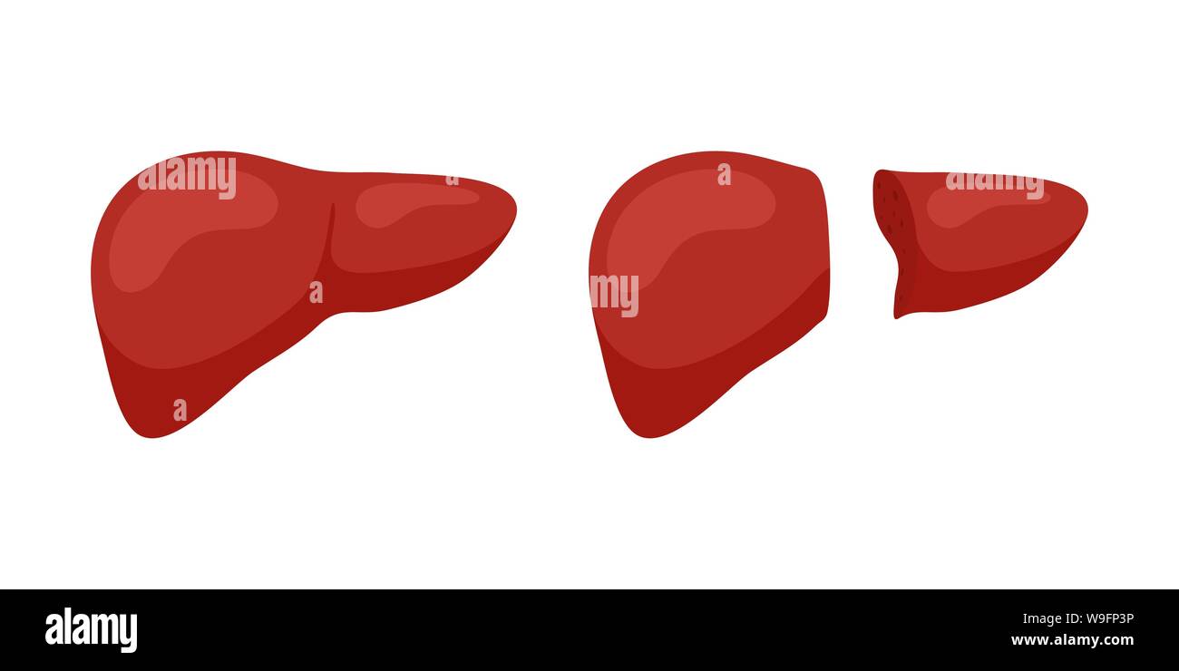 Living donor right lobe liver transplantation concept. Human exocrine gland organ transplant operation concept. Vector flat illustration Stock Vector