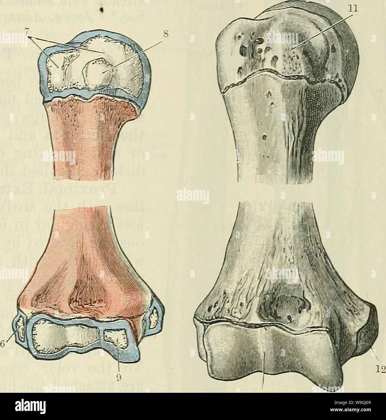 Archive image from page 242 of Cunningham's Text-book of anatomy (1914). Cunningham's Text-book of anatomy  cunninghamstextb00cunn Year: 1914 ( At birth. About 5 years. Fig. 201. About 12 years. -Ossification of the Humerus. About 16 years. 8. Centre for smaller tubercle fuses with other.' centres about 7 years. 9. Appears about 11 or 12 years. 10. Inferior epiphysis fuses with shaft about 16 to 17 years. 11. Superior epiphysis fuses with shaft about 25 years. 12. Fuses with shaft about 17 to 18 years. 1. Appears early in 2nd month fcetal life. 2. For larger tubercle, appears 2 to 3 years. 3. Stock Photo