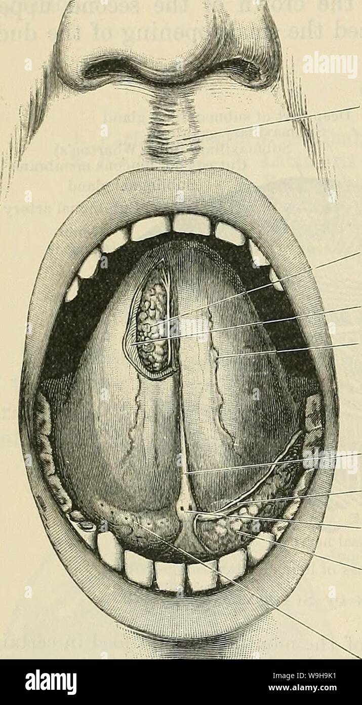 Archive image from page 1141 of Cunningham's Text-book of anatomy (1914).  Cunningham's Text-book of anatomy cunninghamstextb00cunn Year: 1914 ( 1108  THE DIGESTIVE SYSTEM. If, however, the tongue is raised, there is exposed