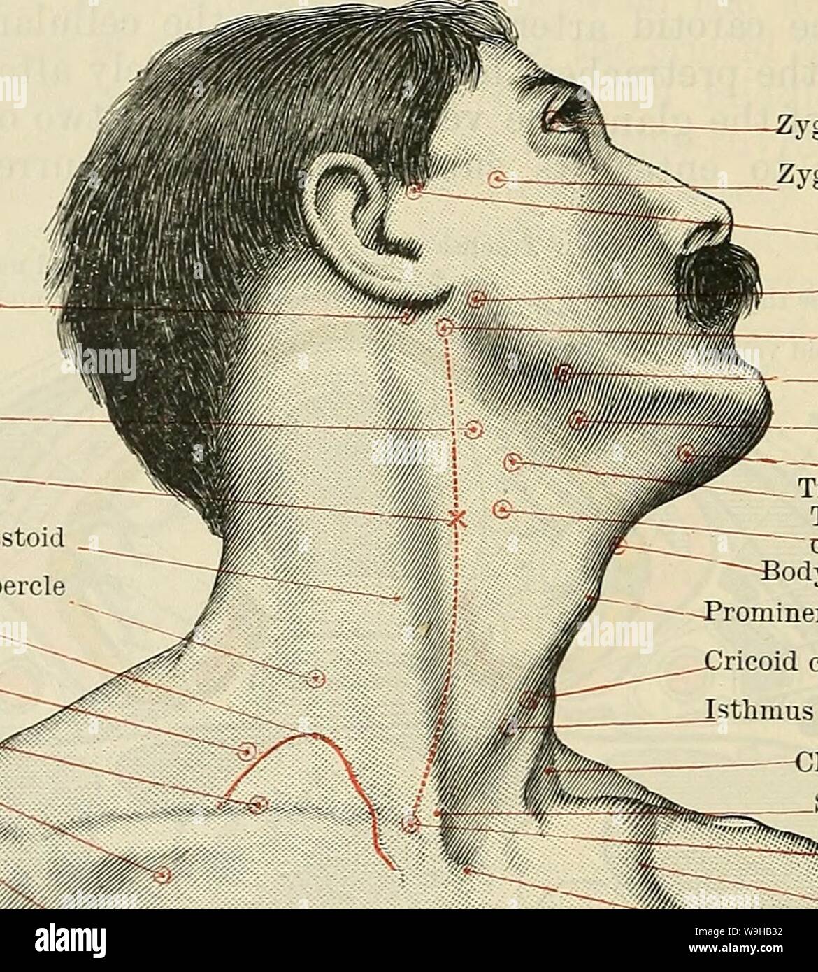 Archive image from page 1423 of Cunningham's Text-book of anatomy (1914). Cunningham's Text-book of anatomy  cunninghamstextb00cunn Year: 1914 ( ygomatie process of frontal Zygoma Temporal artery Facial nerve Transverse process of atlas External maxillary artery Submaxillary gland ——-Anterior belly of digastric — Tip of greater cornu of hyoid bone Tip of superior cornu of thyreoid cartilage Body of hyoid bone -Prominentia laryngea ricoid cartilage  Isthmus of thyreoid gland -—Clavicular head of sterno-mastoid Sternal head of sterno-mastoid 232»b». Bifurcation of innominate artery -Infra-clavic Stock Photo