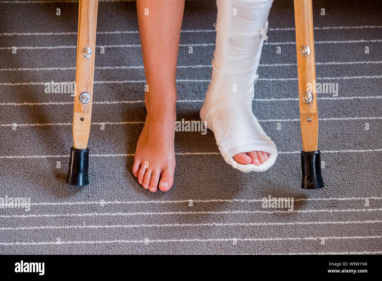 Man Broken Leg On Crutches High Resolution Stock Photography and Images