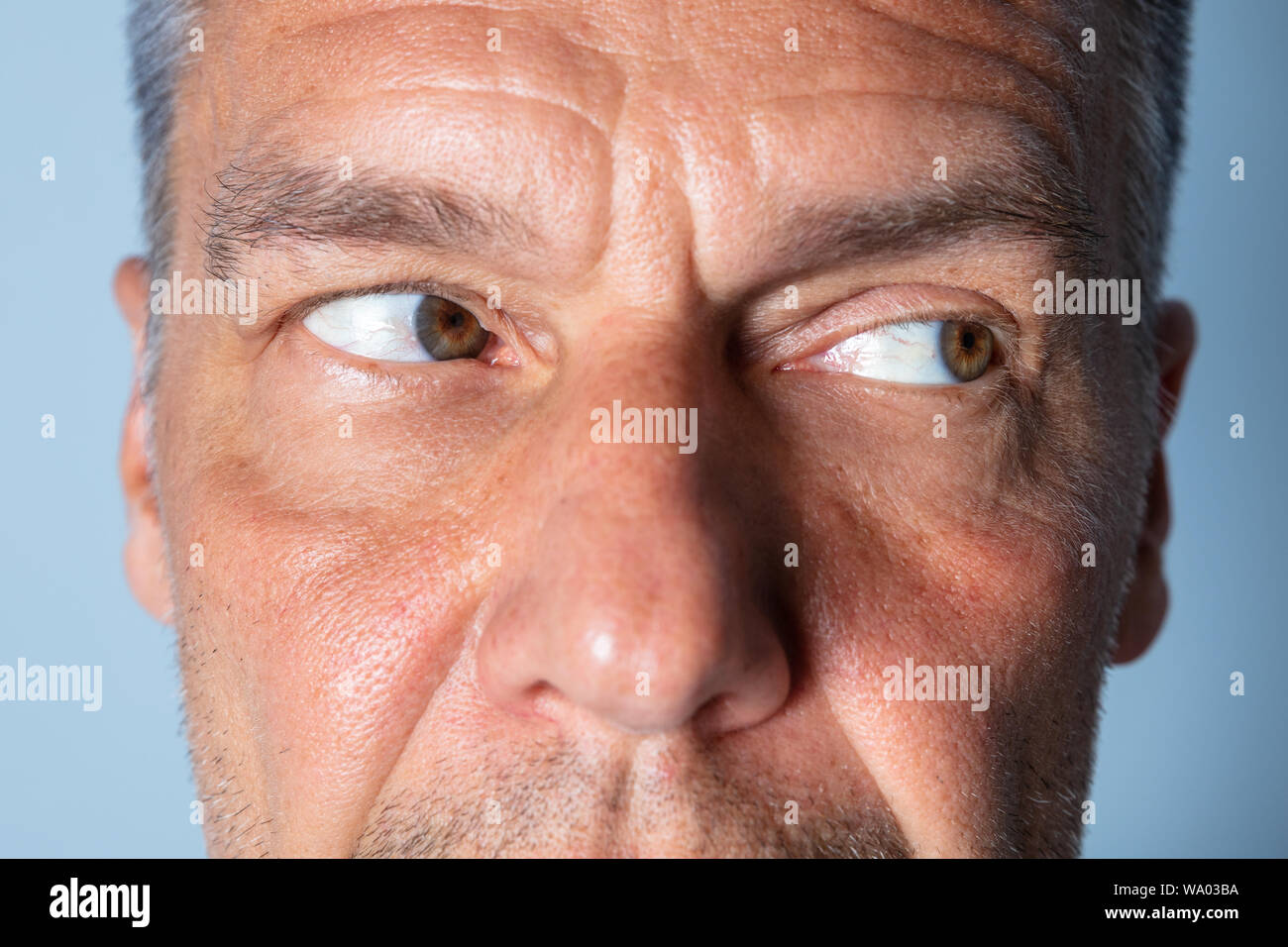 Man Doing Shifting Eye Exercise To Improve Vision Stock Photo Alamy