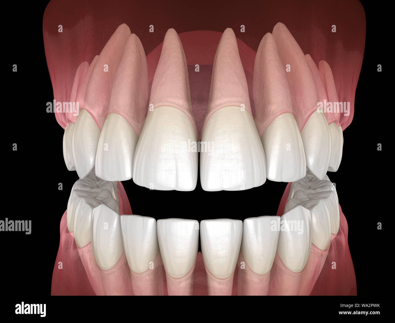 Morphology of mandibular and maxillary human gum and teeth. Medically
