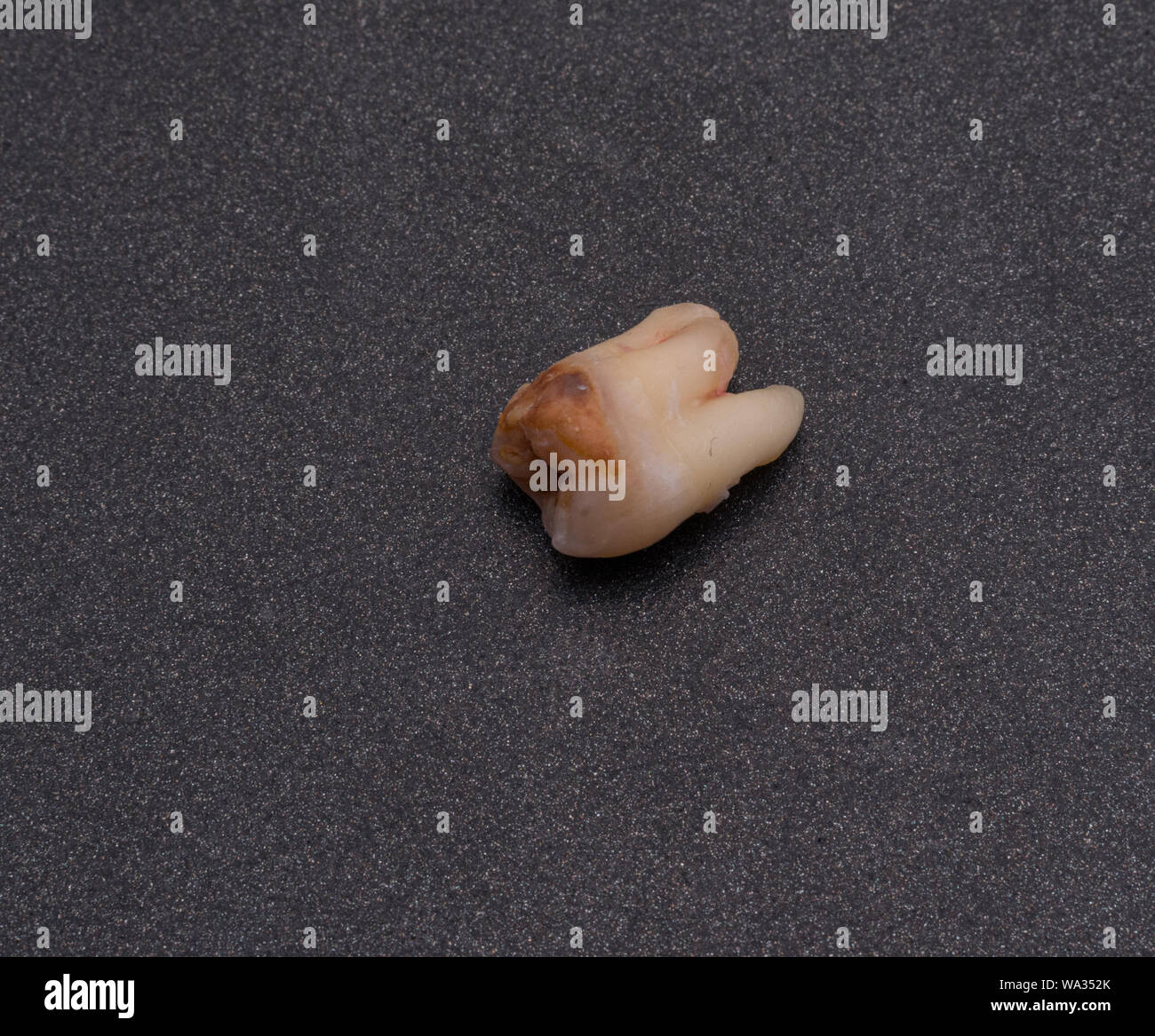 A pulled out wisdom tooth (third molar) on grey background Stock Photo