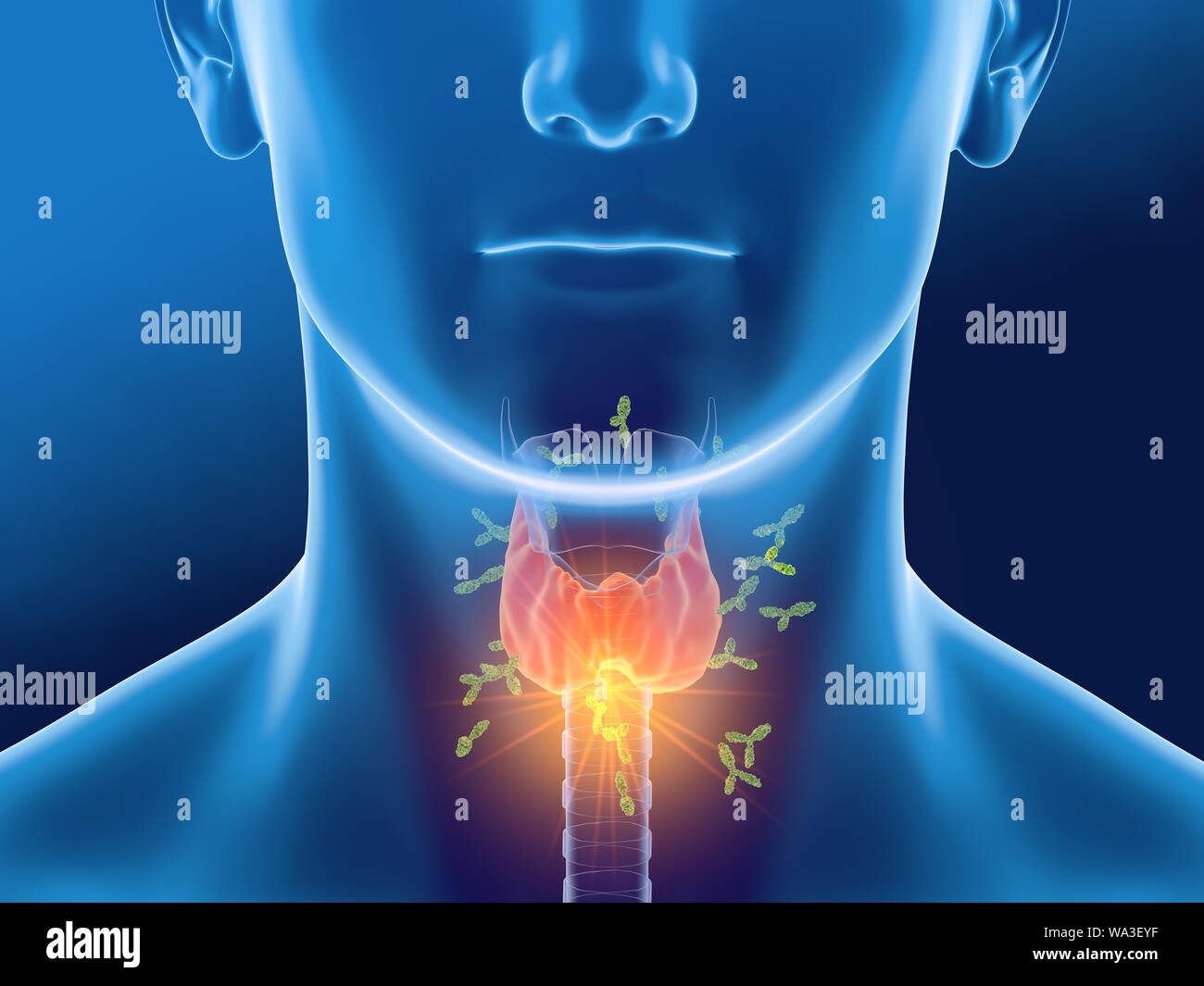 Medically 3D illustration showing antibodies attacking thyroid gland of