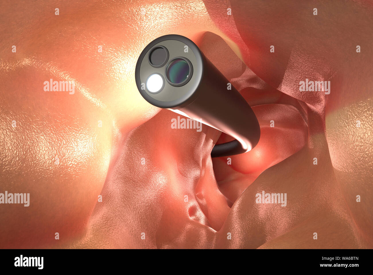 Colonoscopy technology concept with 3d rendering endoscope inside of intestine Stock Photo