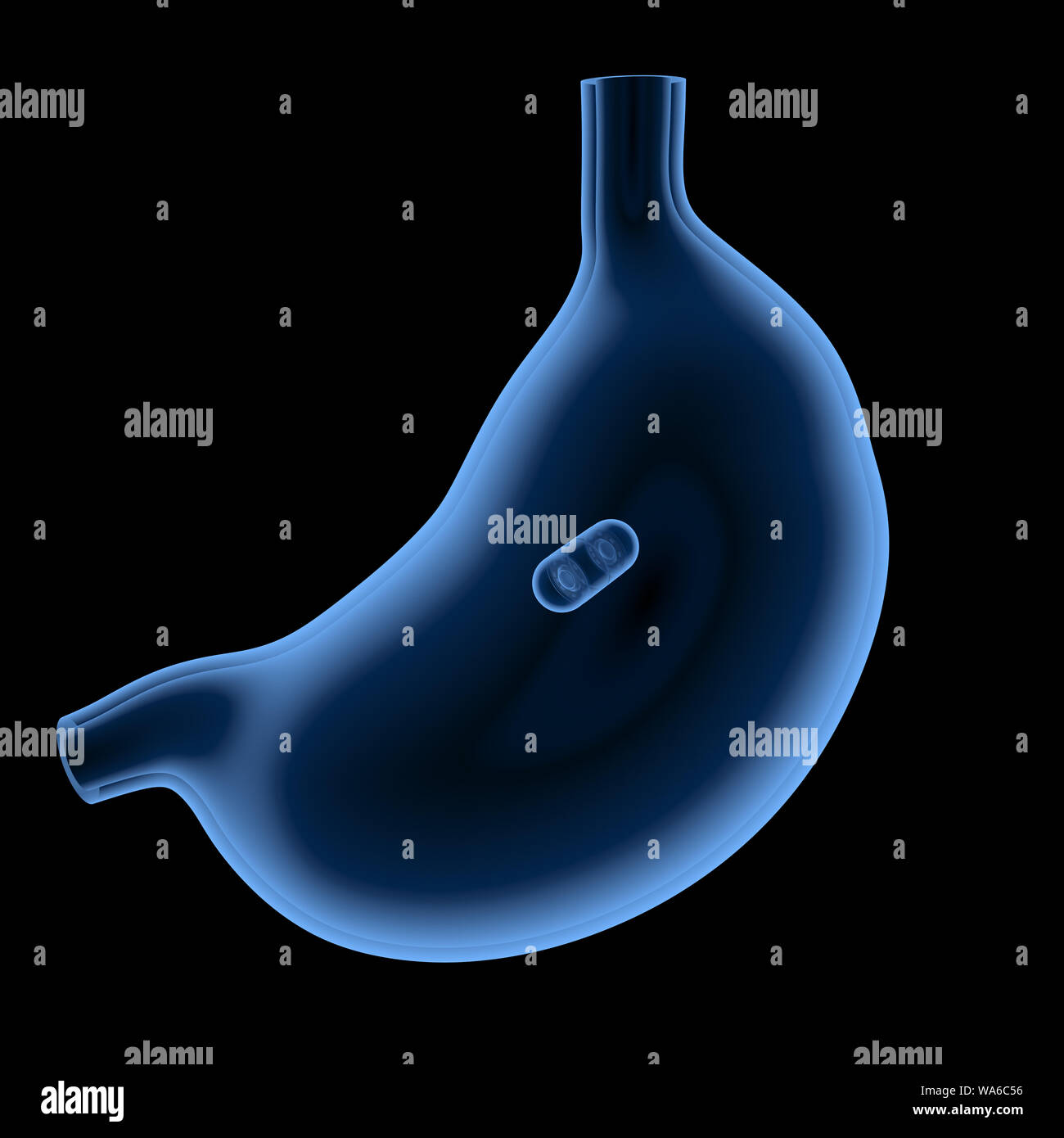 Stomach ulcer endoscopy hires stock photography and images Alamy