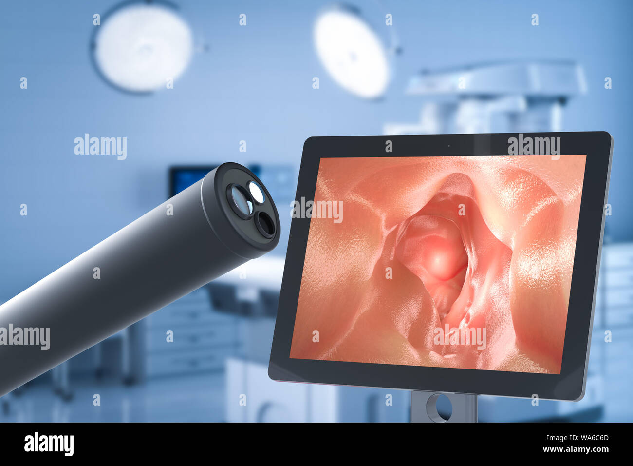 Medical technology concept with 3d rendering endoscope with monitor display intestine Stock Photo
