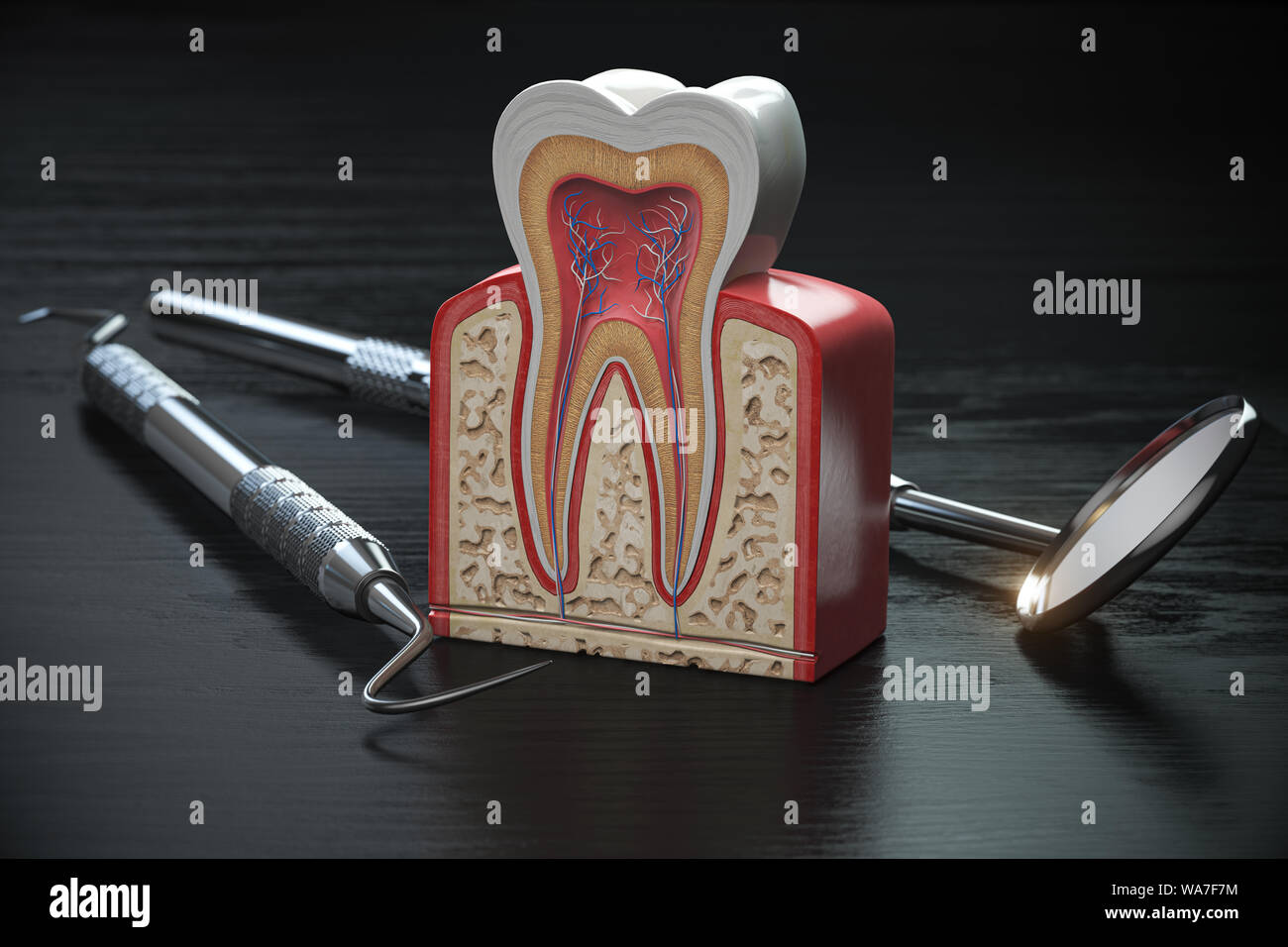Tooth model cross section with dental tools on black wooden table
