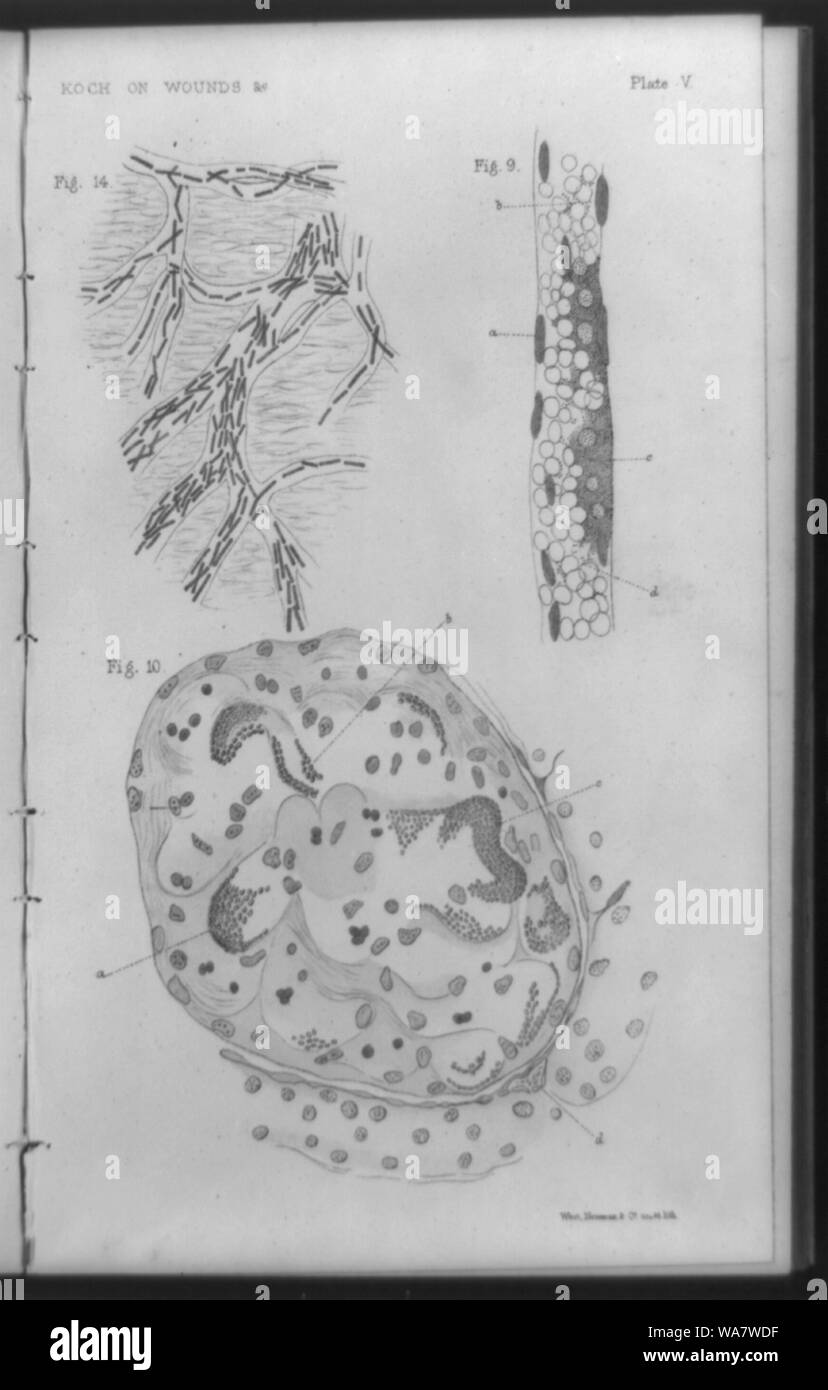 Bacteria found in wounds as drawn from a photomicrograph] / West, Newman & Co., sculpt. lith Stock Photo