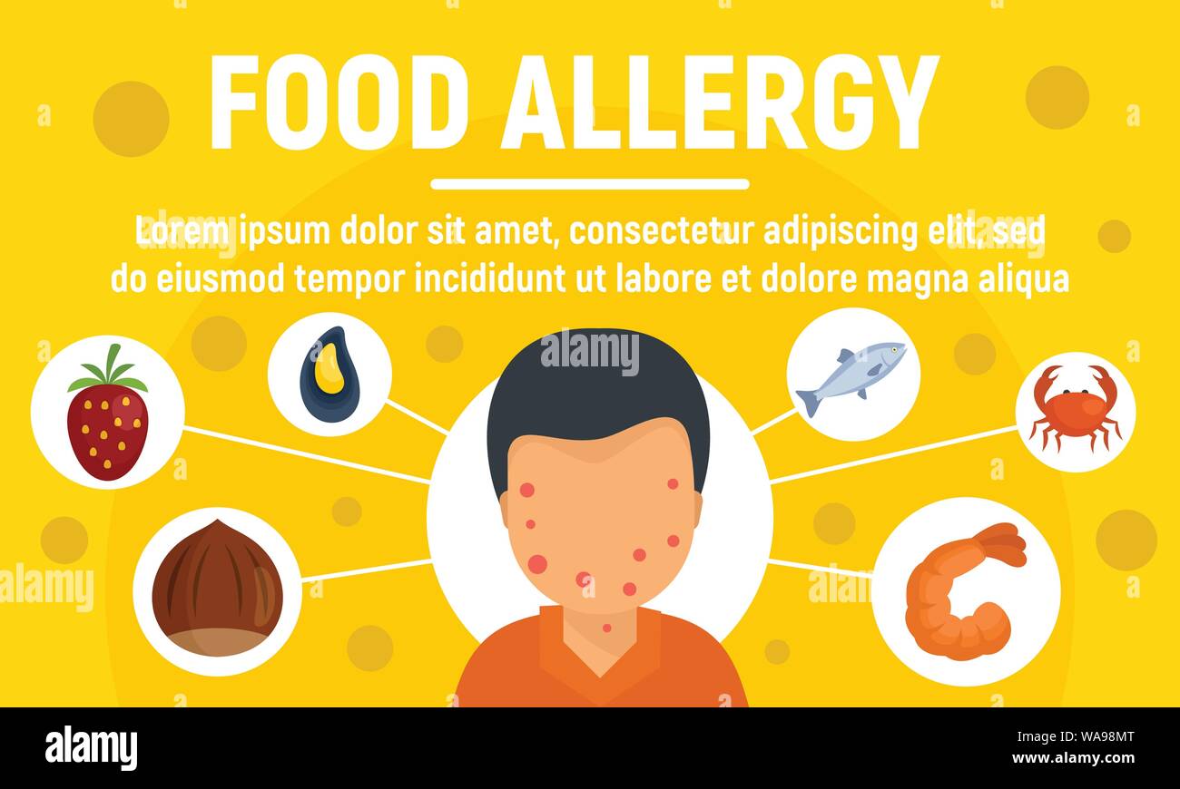 Food allergy concept banner. Flat illustration of food allergy vector concept banner for web design Stock Vector