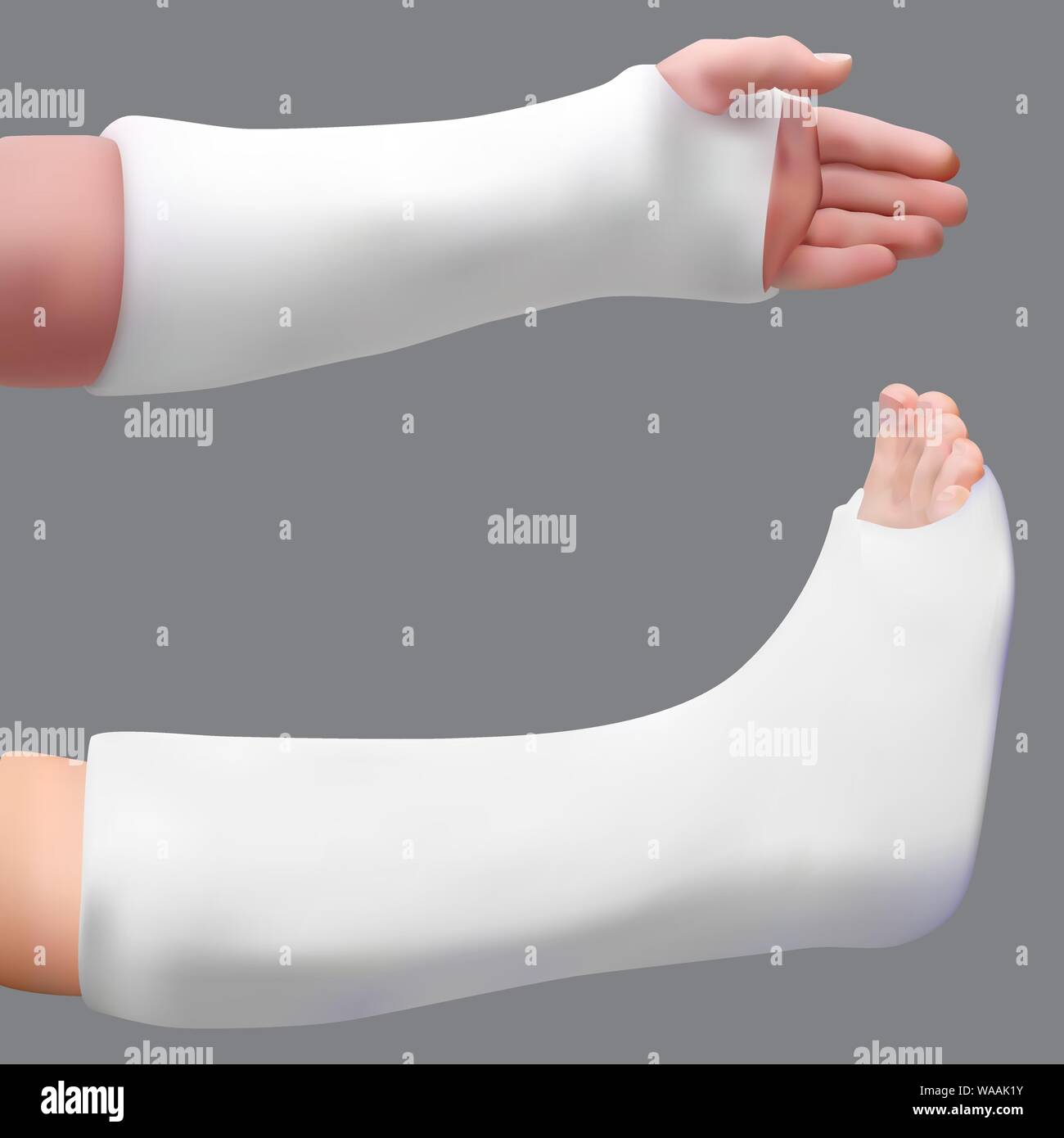 Plastered leg and arm. Treatment of a broken leg and broken arm. Medicine and health. Isolated realistic object. Vector Stock Vector